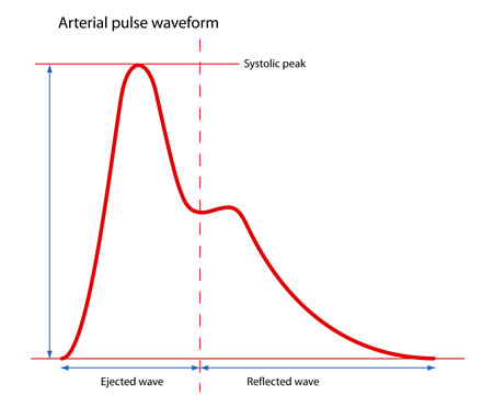 Arterial Pulse Waveform